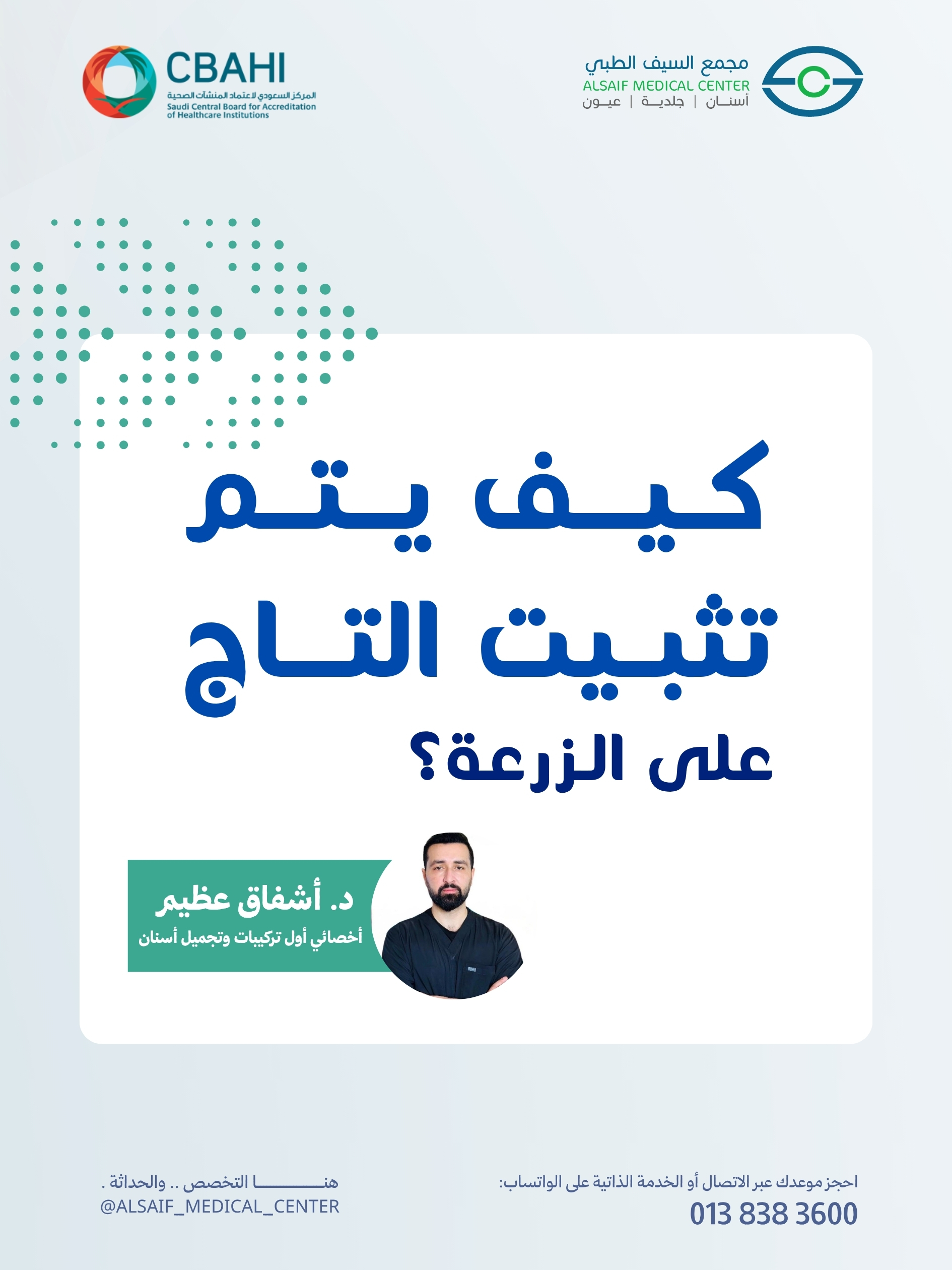 مراحل تركيب التاج النهائي على زرعة الأسنان